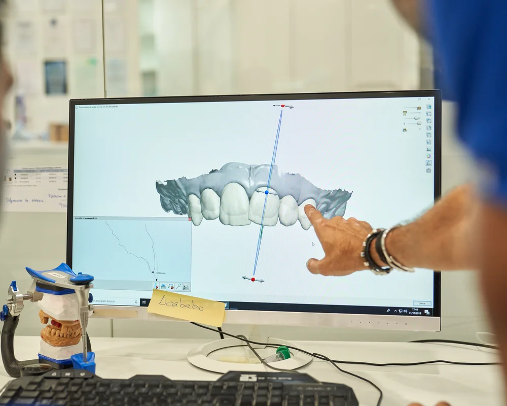 Digital Smile Design