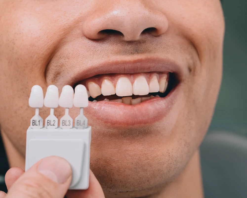 immagine di un sorriso nel dettaglio